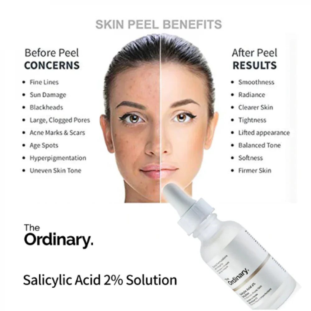 The Ordinary Niacinamide 10% + Zinc 1% 30ml